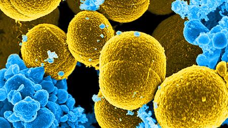 Several mustard-coloured, spherical bacteria in the middle of much smaller blue-coloured blood cells.