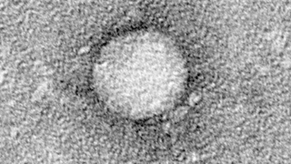 Electron micrograph of a hepatitis C virus particle. Electron micrograph of a hepatitis C virus particle.