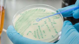 Blaue Bakterienkolonien, die auf einer Agarplatte mit gelbem Agar wachsen, gehalten von einer Hand in einem blauen Handschuh. Eine von einer anderen behandschuhten Hand gehaltene Plastik-Inokulationsöse schwebt über den Kolonien, bereit, eine Kolonie aufzunehmen..