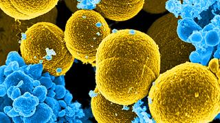 Several mustard-coloured, spherical bacteria in the middle of much smaller blue-coloured blood cells.