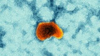 Masernimpfvirus als Vektor