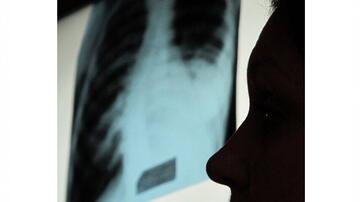 Profile of a man inspecting a lung X-ray image Profile of a man inspecting a lung X-ray image